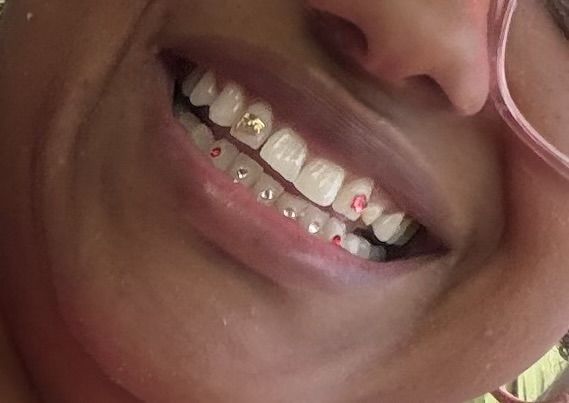 Close-up of a smile with gold, crystal, and pink tooth gems